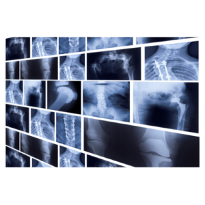 X-Ray Technology